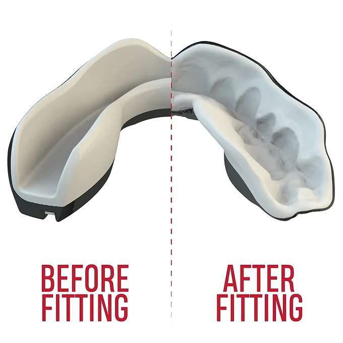 SAFEJAWZ® Extro Series Mouthguard Kids